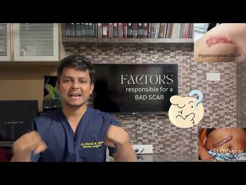 All about Scars