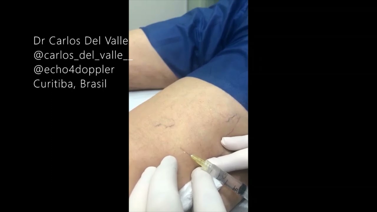 Carlos Eduardo Del Valle-7