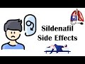 Sildenafil (Viagra) - Side Effects