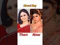 Ugly To Beautiful After Plastic Surgery I Bollywood Actresses