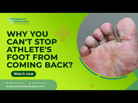 Why You Can't Stop Athletes Foot From Coming Back