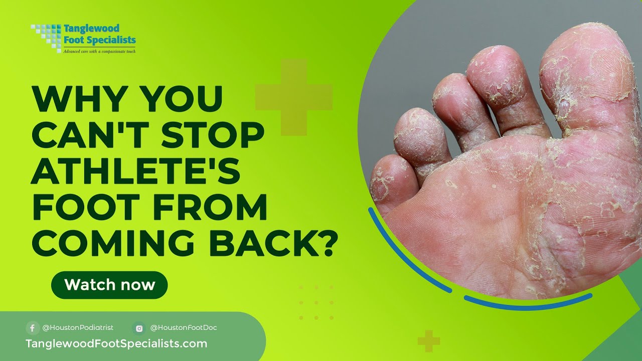 Why You Can't Stop Athletes Foot From Coming Back