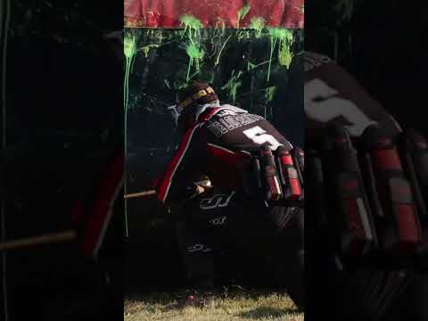 Got Shot In The Face!