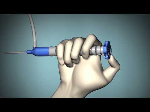 Bravo pH Monitoring - 3D Animation