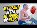 MY HEART AFTER 10 YEARS OF PEDs