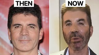 Simon Cowell NEW LOOK | Plastic Surgery Analysis