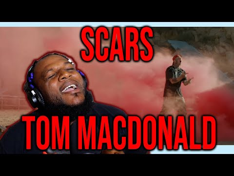 TWIGGA HAS SCARS EVERYWHERE FROM LIFE - Tom MacDonald - "Scars"(REACTION)