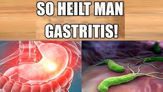 Gastritis heilen  Beseitige deine Gastritis schnell und natürlich - Einfaches Heilmittel