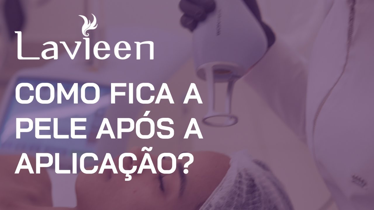 Laser Lavieen - Como fica a pele após a aplicação?