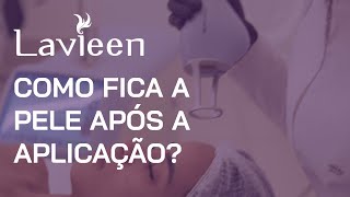 Laser Lavieen - Como fica a pele após a aplicação?