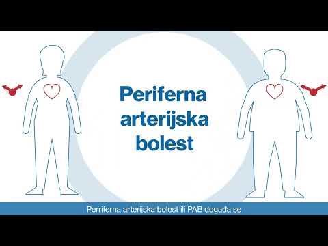 Što su kardiovaskularne bolesti?