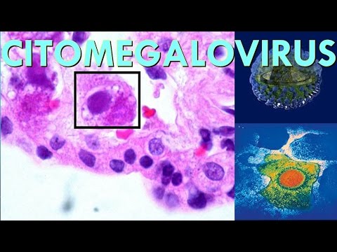 Stecche per caviglia Cosa pungere di dolore