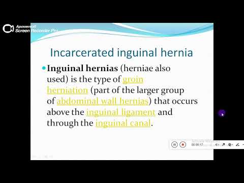 Quiz powerpoint video - case 169 - Refresh your knowledge