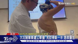 騎單車遭公車迎面撞上!55歲男肋骨斷一半 肺重創奇蹟復原