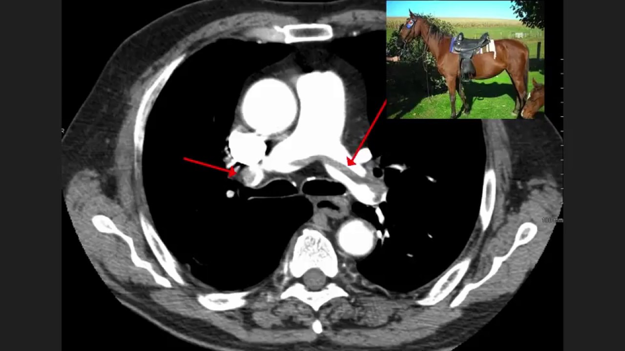 High Yield CT Scans (Part 1) || USMLE