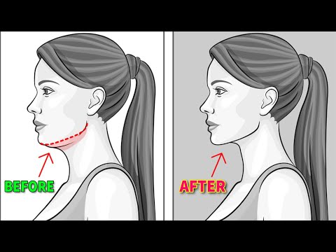 DAY 7 OF 10 | DOUBLE CHIN + FACE FAT + NECK FAT | LOOK YOUNGER WITH BABY FACE
