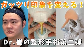Dr.崔のアップデート企画 第二弾の手術が決定！