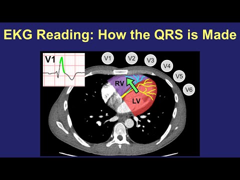 EKG Reading: How the QRS is Made