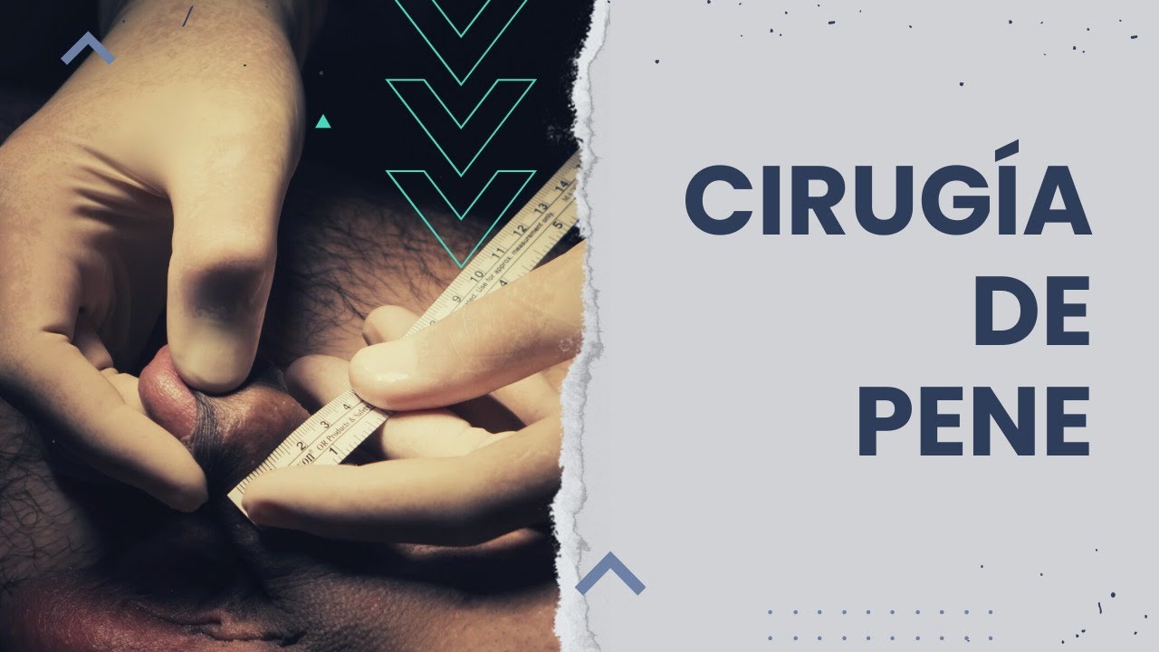 Alexo Carballeira Braña-14