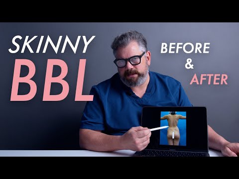 Skinny BBL Results - Before and After