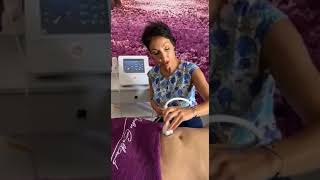 La Radiofréquence Corps