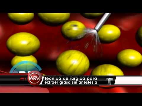 download lagu mp3 mp4 Suave Brisa Colombia, download lagu Suave Brisa Colombia gratis, unduh video klip Suave Brisa Colombia