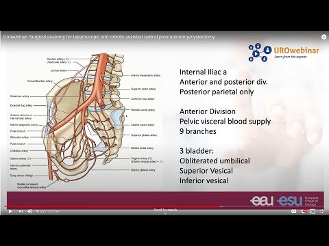 Urowebinar: Surgical anatomy for laparoscopic and robotic assisted radical prostatectomy/cystectomy