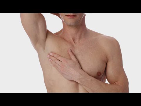 Hilfe für Männer mit weiblichen Brüsten