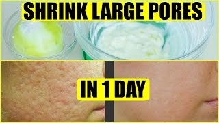 How To Get Rid Of Large Pores In 1 Day | SuperPrincessjo
