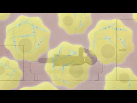 KILLER DISEASES | How Leishmaniasis Affects the Body