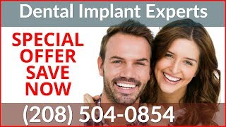 Dental Implant Cost Meridian ID ☎ (208) 856-0684 Dental Implants Special Offers Meridian Idaho