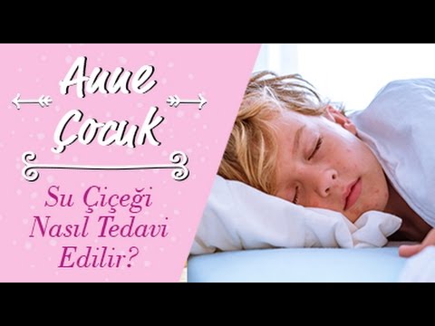 Su Çiçeği Nasıl Tedavi Edilir?