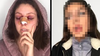 I GOT A NEW FACE AND THIS IS WHAT HAPPENED