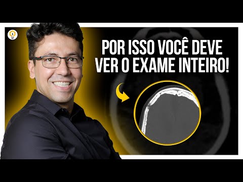 Resolução de Estudo de Caso de TC de CRÂNIO