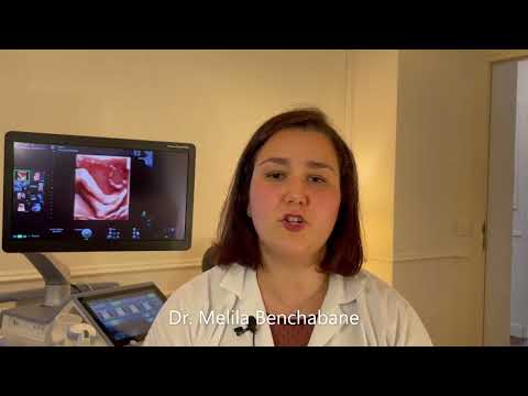 What happens during a third-trimester ultrasound? And what can be seen?