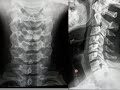 Anatomia por imagenes: Columna vertebral