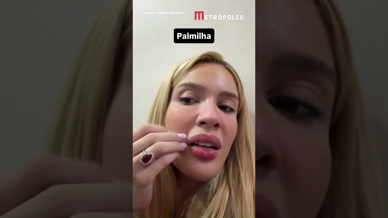 Karoline Lima detalha diagnóstico da filha e explica perninhas moles