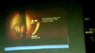 4_Dr. Faisal  Amyloid Mucin part 3