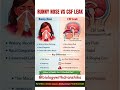 Runny Nose 🤧 vs CSF Leak 🧠💧 – Know the Difference! #runnynose #csff #leak #knowthedifference