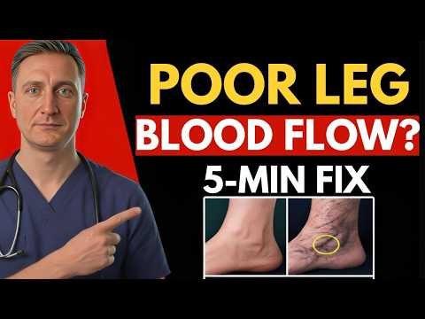 Poor Leg Circulation? 30-Second Test + 3 FAST Fixes | Dr. Michael Kent