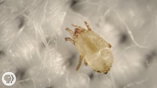 Meet the Dust Mites, Tiny Roommates That Feast On Your Skin  |  Deep Look