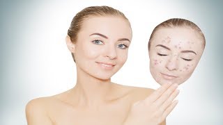 How to Get Rid Of Dark Spots On Your Face Overnight Naturally