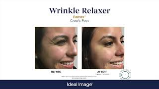 Ideal Image MedSpa- The Advanced MedSpa