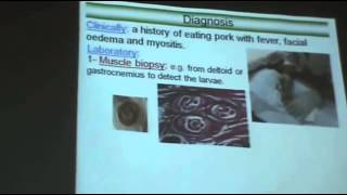 Dr Azza  Parasitology   Nematodes 6   Tissue Nematodes   YouTube