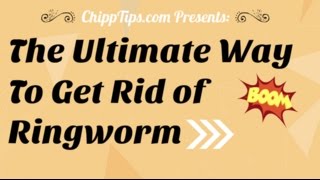 How to Get Rid of Ringworm at Home | Fastest Way to Get Rid of Ringworm in Humans
