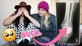 I BROKE MY ANKLE ROLLER SKATING :(