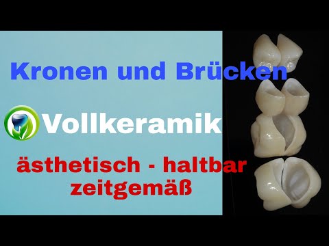 Kronen und Brücken, Teilkronen - Vollkeramik - Zirkon, Lithiumdisilikat