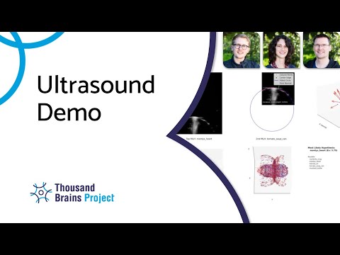 2025/02 - Ultrasound Demo