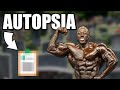 La MORTE di GEORGE PETERSON | Ecco L'AUTOPSIA *Cuore di 500gr!*