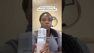 Download lagu What Happens If Your Ingrown Toenail Comes Back? #ingrowntoenailtreatment #ingrowntoenailsurgery mp3